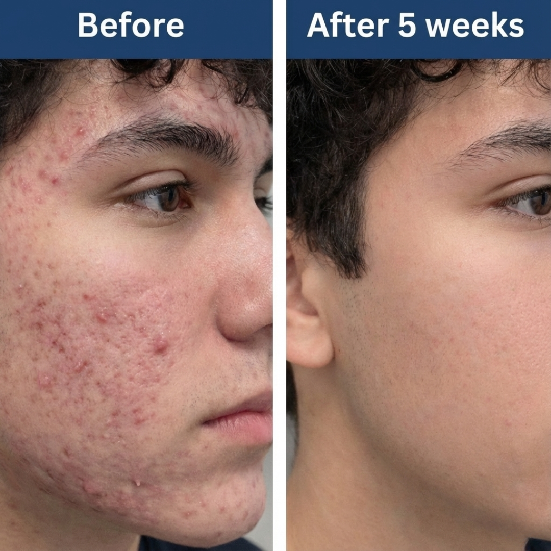 LUMBBR Copper Peptides Serum